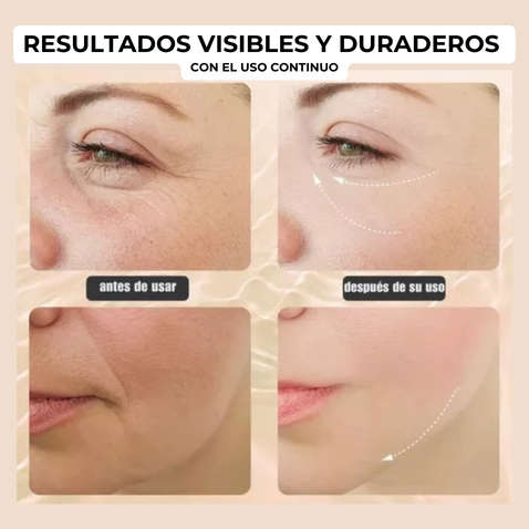 Reafirmante Facial Anti-age Led: combate la flacidez, tonifica y rejuvenece con tecnología EMS y luz roja.